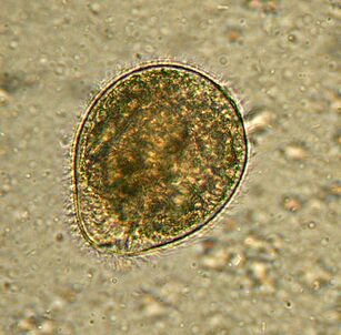 Balantidium mangrupikeun parasit protzoan pangageungna