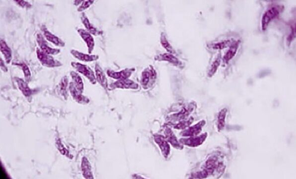 protezoan parasit toxoplasma gondii agén panyababna toksoplasmosis