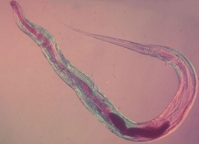 Pinworm handapeun mikroskop