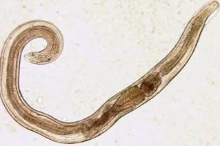 manusa parasit pinworm